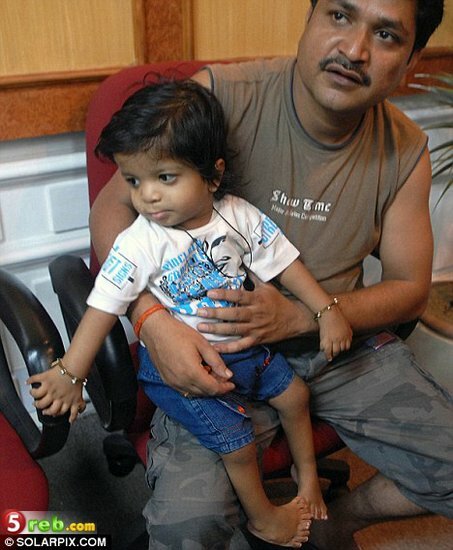 طفل هندي يدخل موسوعة جينس ب 34 أصبع